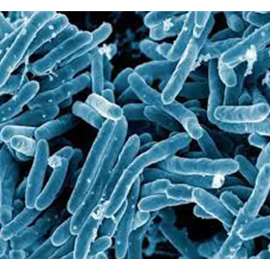 mycobacterium tuberculosis dna pcr, quantitative